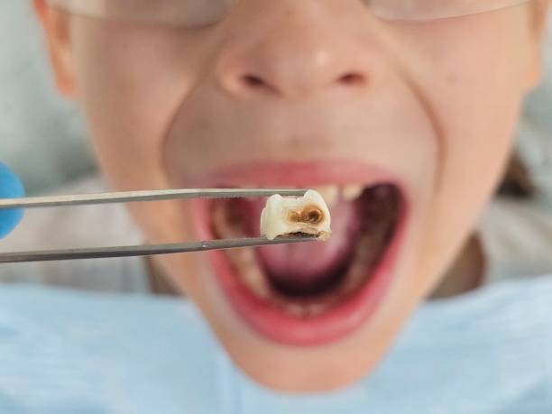 Best Broken Tooth Emergency  in Butler, PA